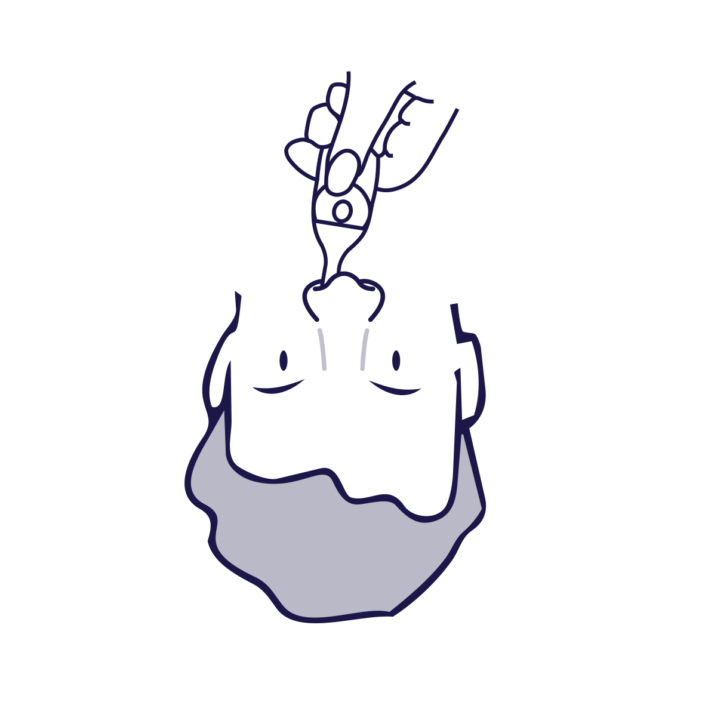 Step 2
